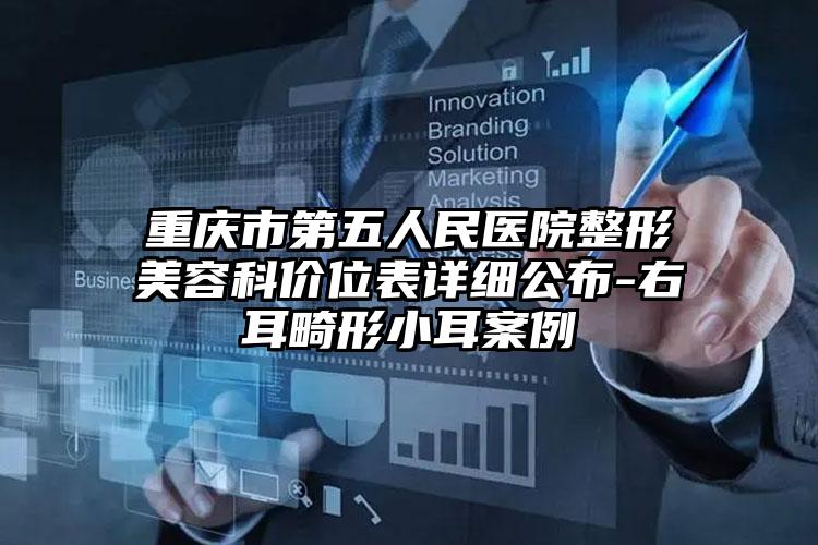 重庆市第五人民医院整形美容科价位表详细公布-右耳畸形小耳案例