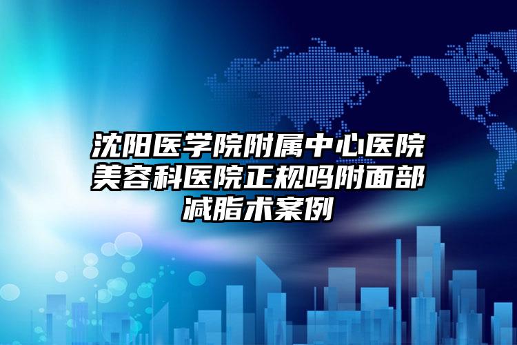 沈阳医学院附属中心医院美容科医院正规吗附面部减脂术案例