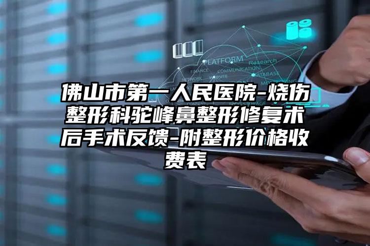 佛山市第一人民医院-烧伤整形科驼峰鼻整形修复术后手术反馈-附整形价格收费表
